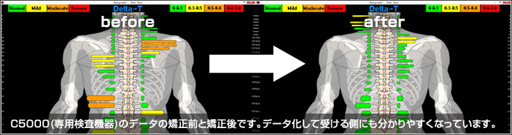 c5000(専用検査機器)のデータの矯正前と矯正後です。データ化して受ける側にも分かりやすくなっています。
